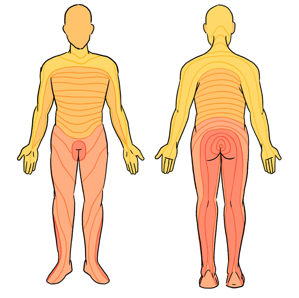 Dermatomes Dermatomes