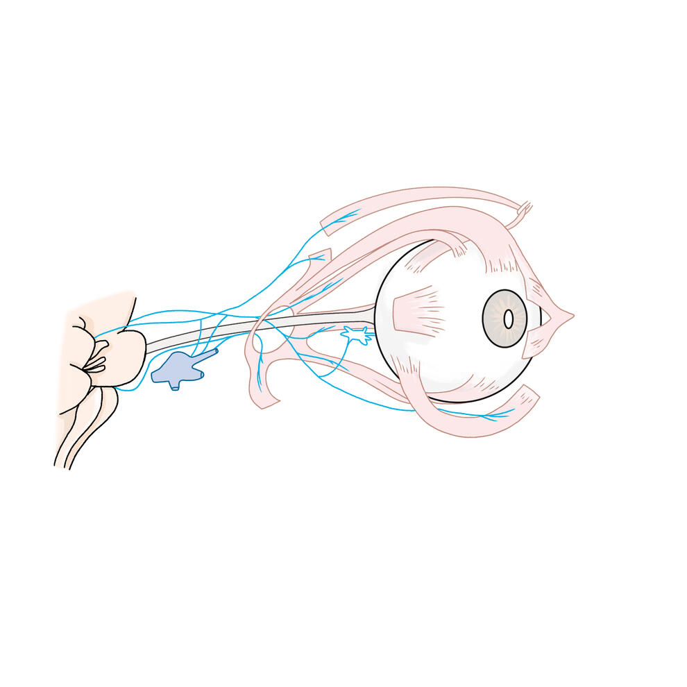 Optic Nerves Optic Nerves